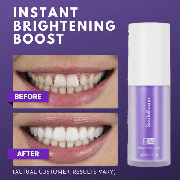 Color Correction Serum - Tooth Whitening