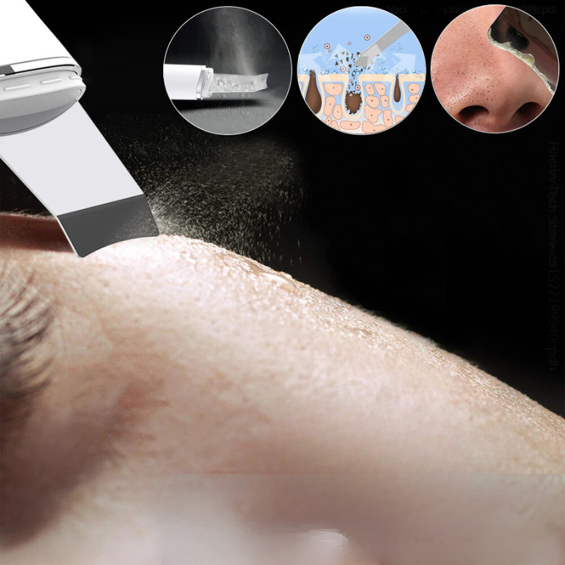 Advanced Facial Exfoliator for Deep Cleansing – Electric Skincare Tool for Smooth Skin and Daily Face Care