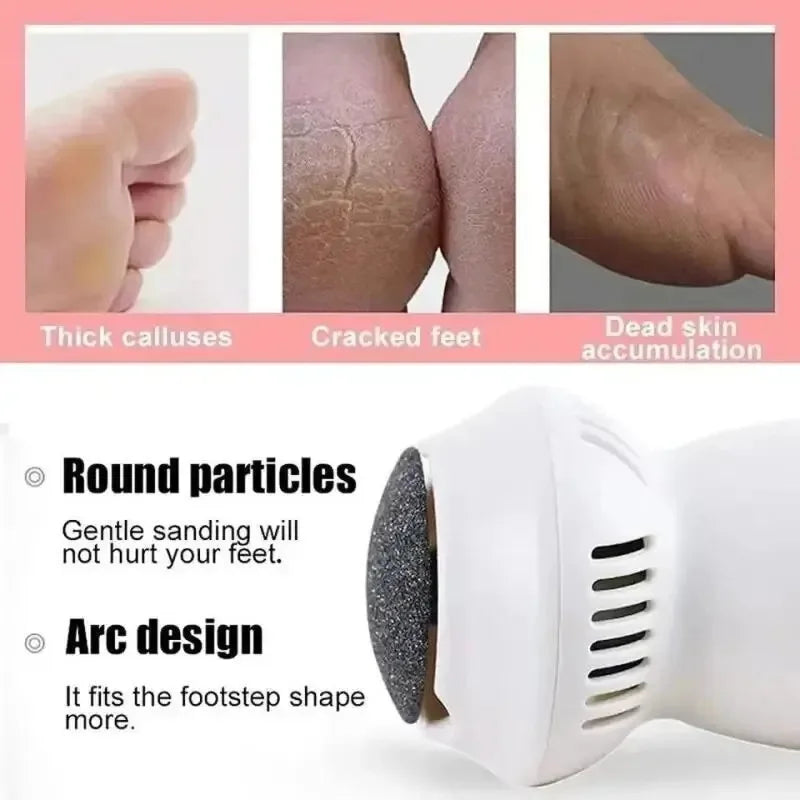 Electric Professional Callus Remover - Clean and Efficient