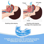 AureaGuard | Customizable Anti-Snoring Mouthpiece for Restful Sleep