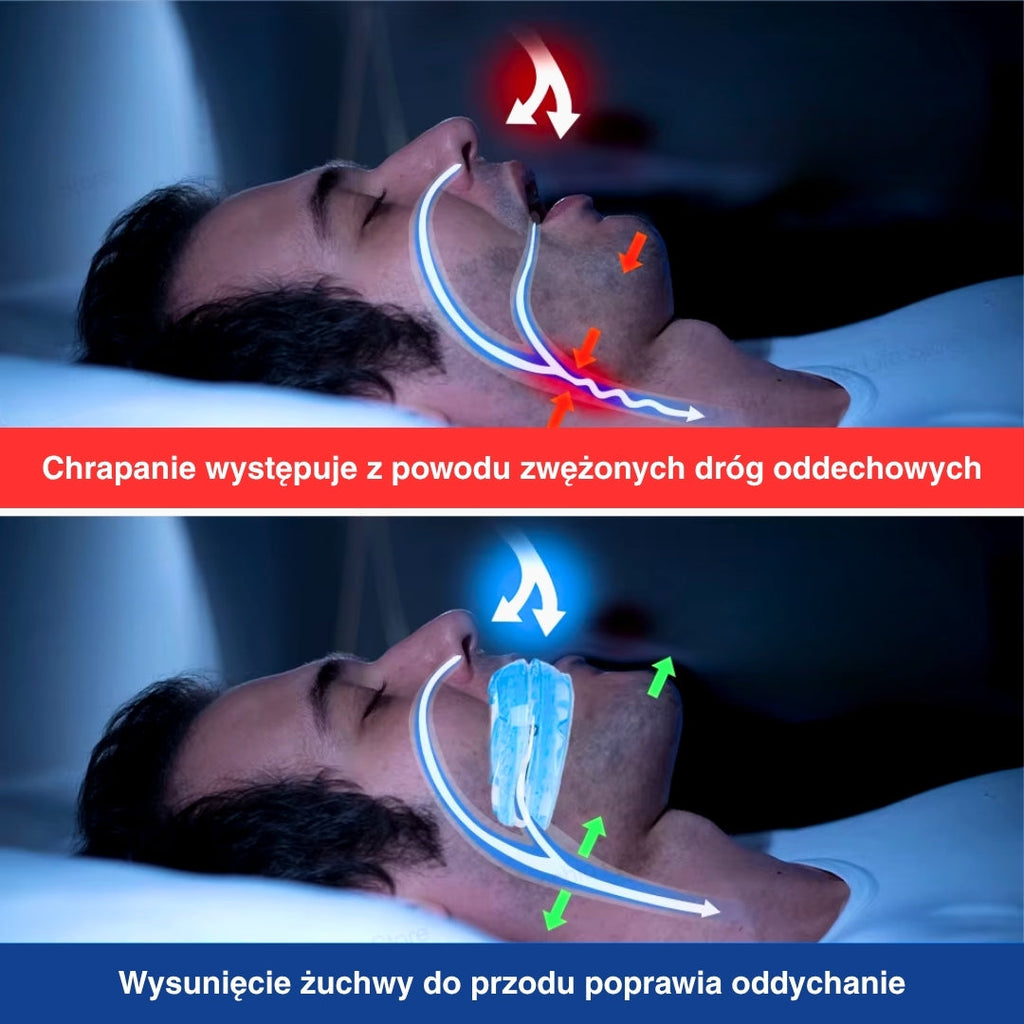 AureaGuard | Customizable Anti-Snoring Mouthpiece for Restful Sleep