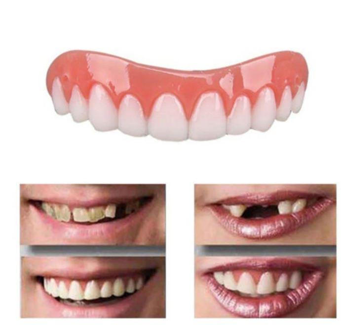 AureliaSmile | Revolutionary Comfortable Dental Cover for Perfect Teeth