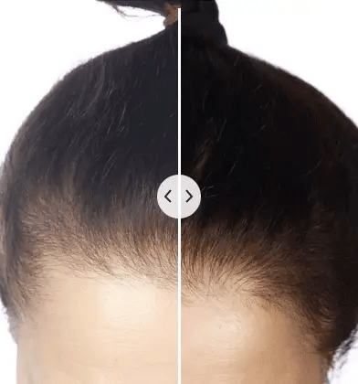 5-in-1 Hair Comb for Styling and Scalp Massage – Versatile Hair Care Tool for Detangling, Grooming and Daily Use