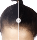 5-in-1 Hair Comb for Styling and Scalp Massage – Versatile Hair Care Tool for Detangling, Grooming and Daily Use