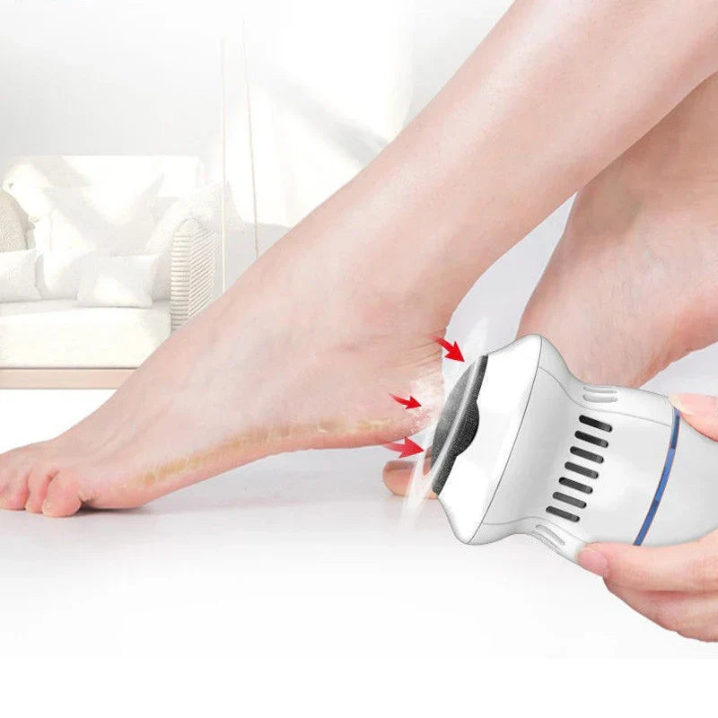 Electric Professional Callus Remover - Clean and Efficient