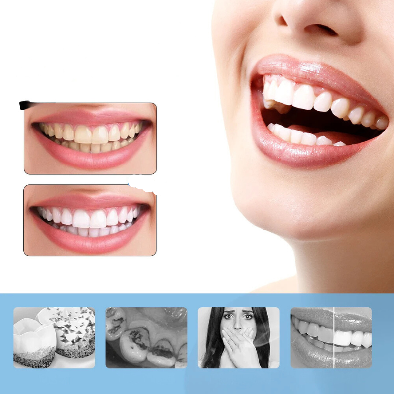 Electric Teeth Cleaning Device with Adjustable Speeds – Home Dental Care Tool for Plaque Removal and Daily Oral Hygiene