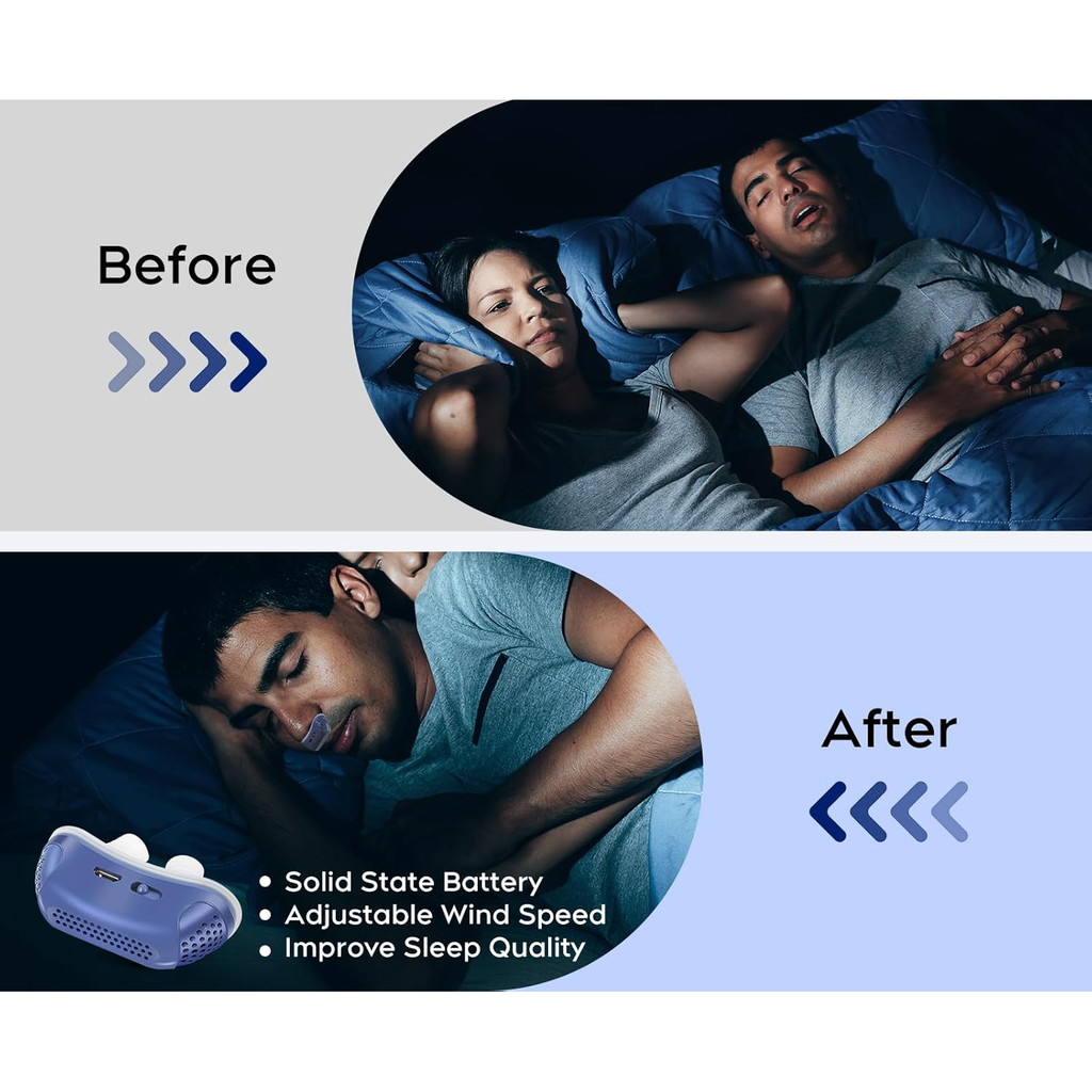 Anti Snoring Device USB Charged Anti-Snoring Rechargeable - Image 8