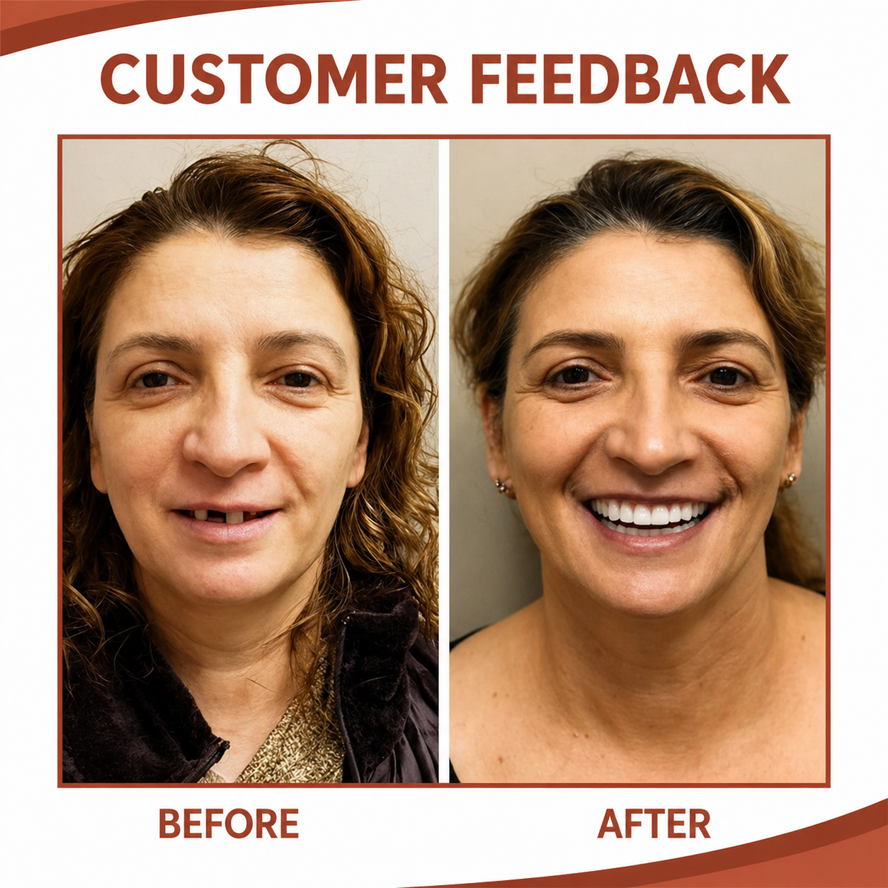Cosmetic Removable Silicone Snap on Veneers Teeth Temporary Heat Adjustable Upper Lower - Image 3