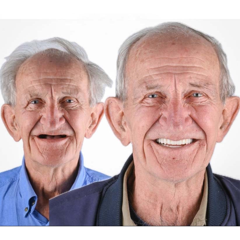 Men's Affordable Dental Implants and Dentures with Flexible Cushion Grip and Storage Case - Image 12
