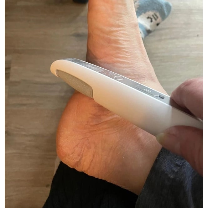 Men's Electric Foot File and Callus Remover with Rechargeable Roller Head - Image 16