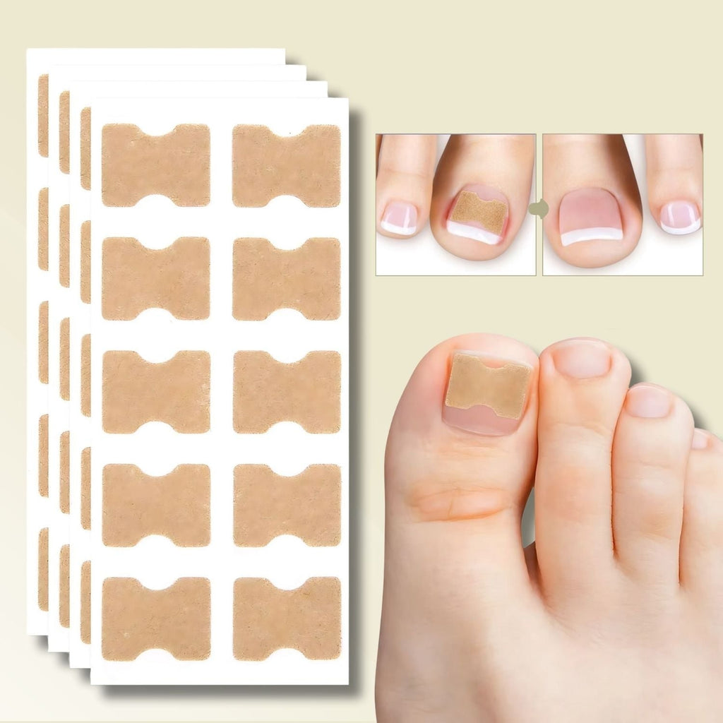 Men's Ingrown Nail Treatment Corrector Patches with Adhesive Peel and Stick Application - Image 1