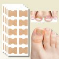 Men's Ingrown Nail Treatment Corrector Patches with Adhesive Peel and Stick Application - Image 1