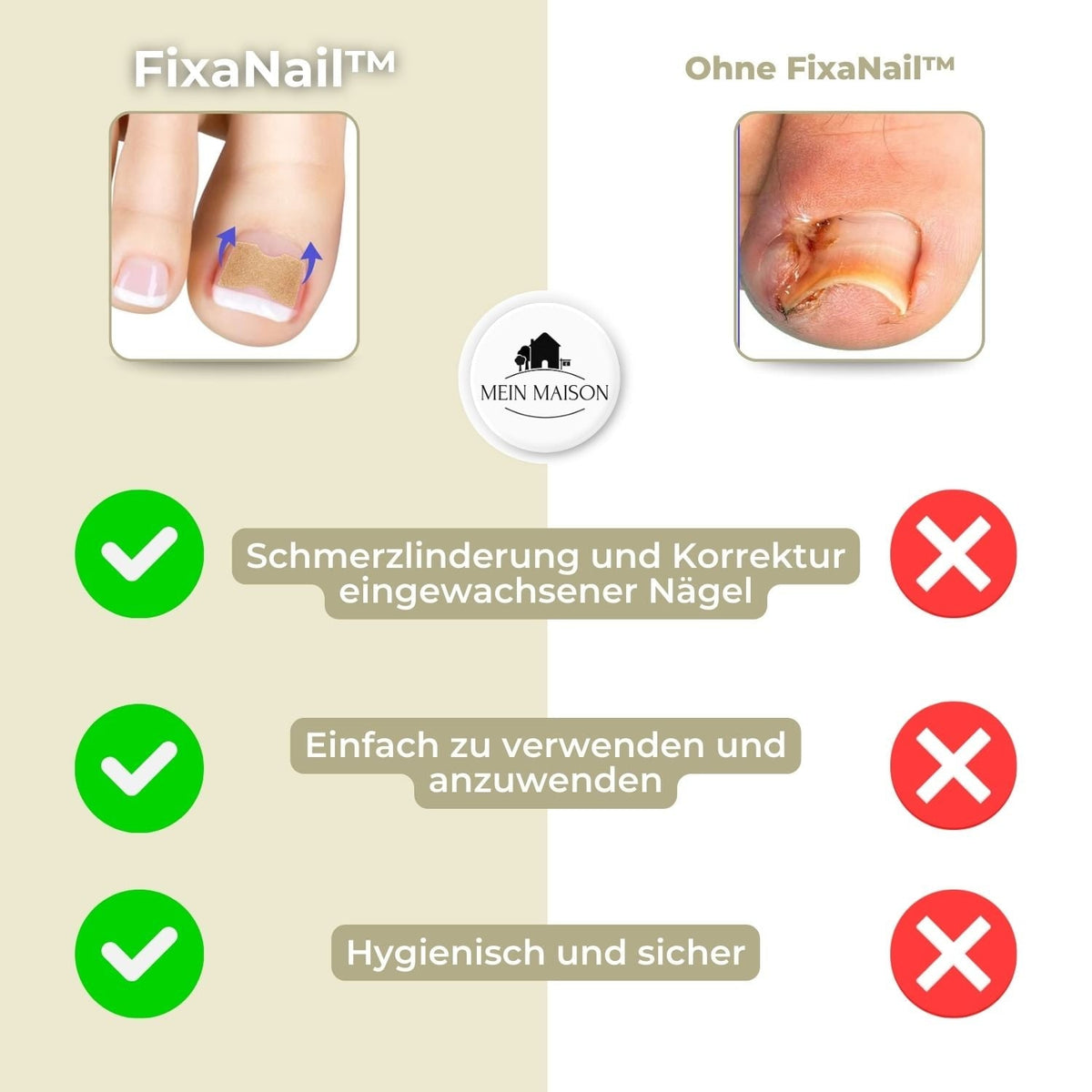 Men's Ingrown Nail Treatment Corrector Patches with Adhesive Peel and Stick Application - Image 6