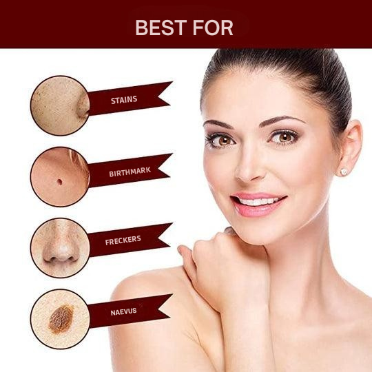 Skin Tag Remover Brush Removal Tool Targeted Treatment Pen Applicator Natural Wart - Image 7