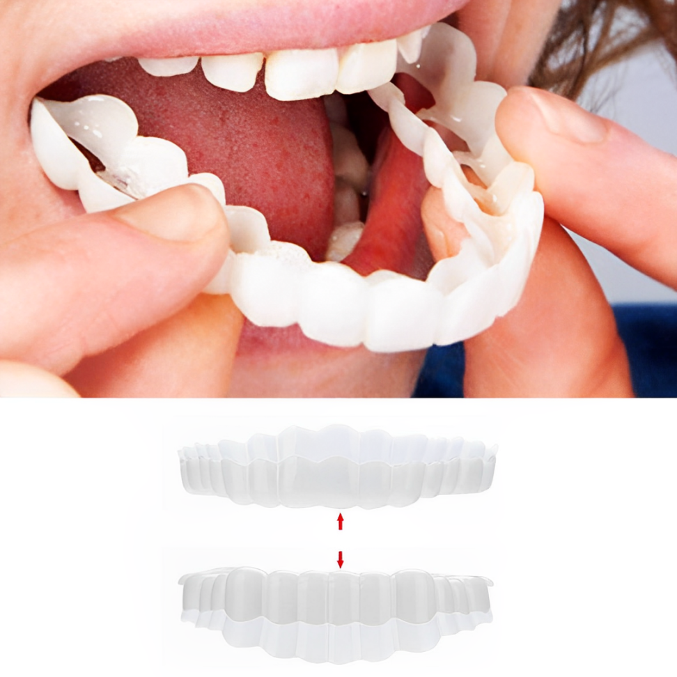 Snap on Veneers Temporary Smile Cosmetic Dental Flexible Removable Upper Lower - Image 1