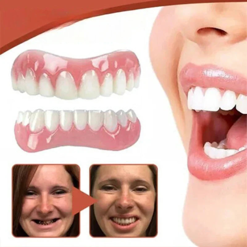 Snap on Veneers with Moldable Thermal Beads and Cosmetic False Teeth Kit - Image 4
