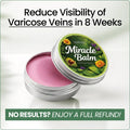 Varicose Vein with Horse Chestnut Arnica Calendula Balm - Image 1