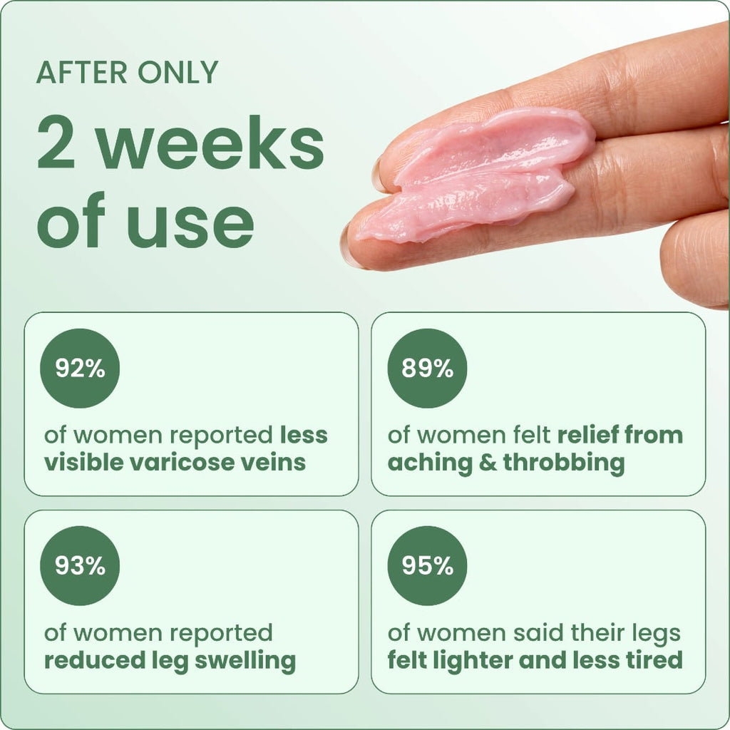 Varicose Vein with Horse Chestnut Arnica Calendula Balm - Image 3